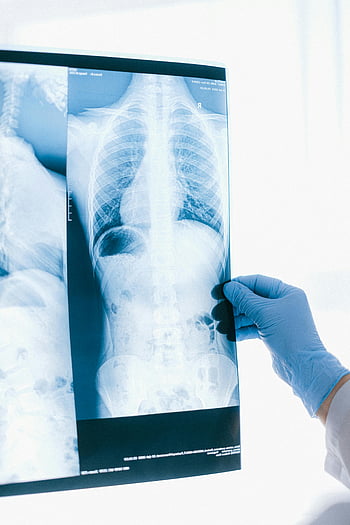doctor, X-ray, chest X-ray, medical professional, blue gloves, analyzing, indoor, healthcare, radiology, medical image, diagnostic