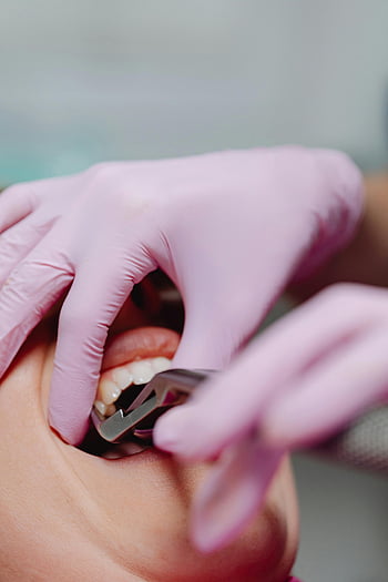 Zubní kontrola, dentální nástroje, vyšetření pacienta, zubní klinika, detail, Zubní rukavice, zubní postup, vyšetření zubů, dentální hygiena, Péče o zuby, zubní ošetření