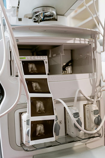 ultrazvukový stroj, lékařské zobrazování, Diagnostické zobrazování, lékařské vybavení, Moderní zdravotní péče, ultrazvukové vyšetření, lékařská technologie, Lékařská diagnostika, lékařské nástroje, 3D ultrazvuk, lékařský skener