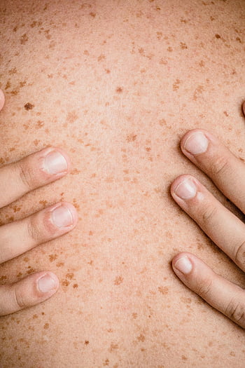 freckled skin, bare back, close-up hands, natural texture, skin texture, freckles, human skin, skin close-up, bare skin, skin detail, hands touching skin