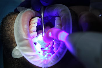 dentist, oral Health, dental Health, oral Hygiene, dental Hygiene, teeth Cleaning, teeth Whitening
