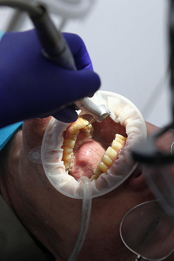 dentist, oral Health, dental Health, oral Hygiene, dental Hygiene, teeth, teeth Cleaning, teeth Whitening