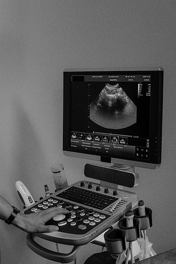 ultrazvukový stroj, fotografie ve stupních šedi, lékařské zobrazování, detail, Ultrazvuková obrazovka, lékařské vybavení, Diagnostický nástroj, Ultrazvuková technologie, zdravotnické zařízení, ve stupních šedi, Ultrazvukové vyšetření