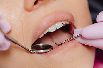 Dental procedure, patient, Dentalundersøgelse, tandlægeværktøjer, hygiejne, omsorg, tæt på, tænder, tandlæge, tandspejl, Dental sonde