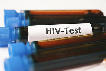 혈액 샘플, HIV 테스트, 의료 검사, 혈액 검사, 의료 샘플, HIV 진단, 혈중, 의료 바이알, 건강 관리, 실험실 테스트