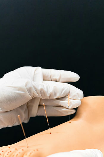 acupuncture, model arm, fine needles, gloved hand, close-up, alternative medicine, acupuncture therapy, medical training, acupuncture model, healthcare, needle therapy