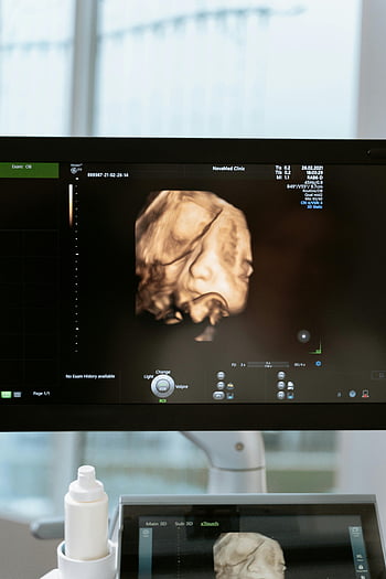 3D超音波、 胎児スキャン、 医療モニター、 クリニックの設定、 出生前のケア、 医療イメージング、 超音波技術、 胎児の発達、 産科、 産前ケア、 健康診断