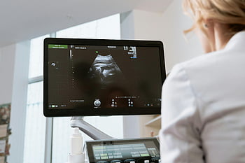 ob-gyn、 超音波スキャン、 健康診断、 医師;医療従事者、 モニター、 見ている、 医療機器、 妊娠、 胎児イメージング、 診療所、 診察室