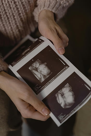 صور الموجات فوق الصوتية،  لحظة الحمل،  عقد اليدين،  الموجات فوق الصوتية للأطفال،  الموجات فوق الصوتية الحمل،  تصوير بالموجات فوق الصوتية،  توقع الوالدين،  إعلان الحمل،  نتائج الموجات فوق الصوتية