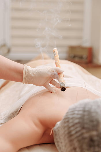 moxibustion therapy, acupuncture, traditional Chinese medicine, smoke stick, white glove, therapy session, healing techniques, alternative medicine, health treatment, relaxation, wellness