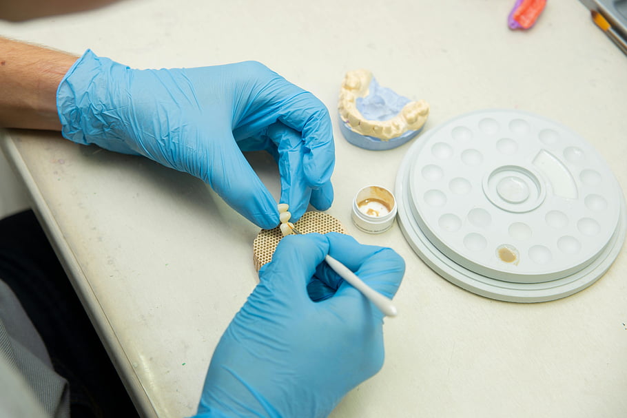 dentální implantáty, zubní technik, zubní implantát, Nastavení laboratoře, dentální nástroje, řemeslné zuby, Zubní specialista, Zubní práce, Dentální protetika, zubní laboratoř, Zubní rukavice