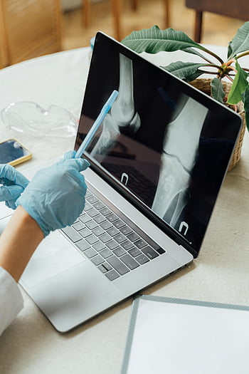 doctor, gloves, bone X-ray, laptop, clinical setting, medical examination, healthcare professional, digital diagnosis, medical technology, patient care, medical imaging