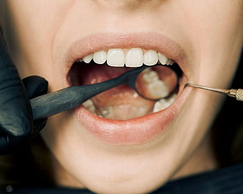 dentist, teeth, dental examination, modern equipment, oral hygiene, close-up, dental tools, dental care, dental check-up, dental health, dental mirror