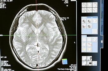 MRI mozkové skenování, lékařská analýza, Diagnostické zobrazování, obrazovka počítače, Lékařská odbornost, zdraví mozku, lékařské zobrazování, radiologie, Technologie MRI, Technologie zdravotní péče, digitální zobrazování
