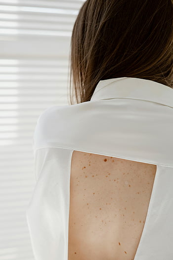 woman, freckles, back, white shirt, indoors, close-up, skin, natural beauty, indoor lighting, casual style, freckled skin