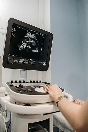 lékařský ultrazvuk, Zdravotník, lékařské zařízení, ultrazvukový stroj, Ultrazvuková obrazovka, lékařské vybavení, Diagnostické zobrazování, zdravotnický pracovník, lékařská technologie, Ultrazvukové vyšetření