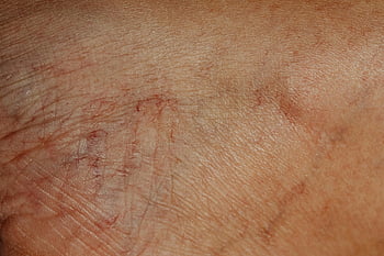 human skin, close-up, texture, wrinkles, aging skin, detailed image, skin texture, skin close-up, skin wrinkles, human skin texture, aging human skin