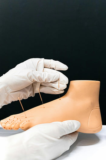 akupunktura, umělé nohy, vzdělávací účely, ruce cvičící, detail, Lékařské školení, nožní model, akupunkturní jehly, bílé rukavice, vzdělávání ve zdravotnictví, alternativní medicína