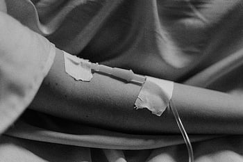 iv kapání, paže pacienta, zdravotní péče, černobílé fotografie, detailní záběr, zavedení dextrózy, Zdravotní snímky, Intravenózní terapie, nemocniční ošetření, léčebného postupu, trpělivá péče