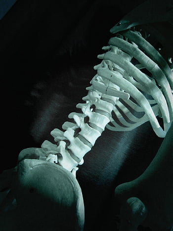 bones, skeleton, model, x-ray, back Bones