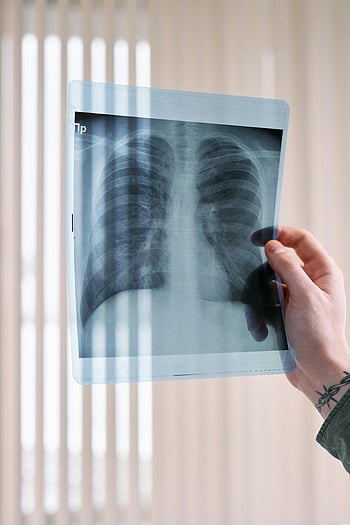 doctor, lung x-ray, medical clinic, healthcare diagnosis, vertical shot, doctor's hand, medical examination, chest x-ray, diagnostic imaging, healthcare professional, medical treatment