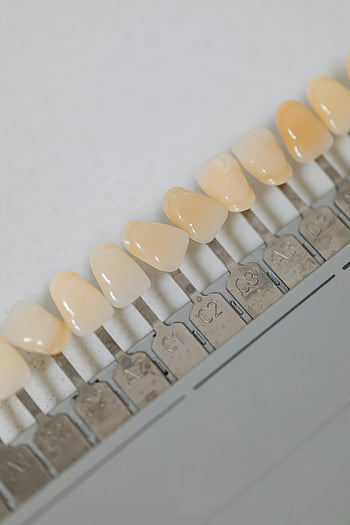 implantes de dientes, guía de sombra dental, Opciones de color de dientes, procedimientos dentales, de cerca, diferentes tonos, implantes dentales, tonos dientes, cuidado dental, estética dental, blanqueamiento del diente